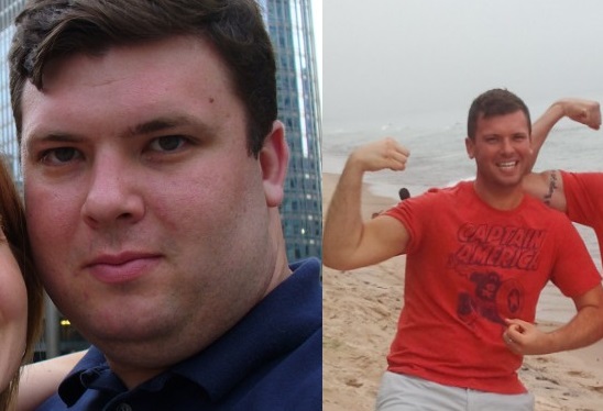 before and after ron