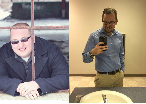zach before and after