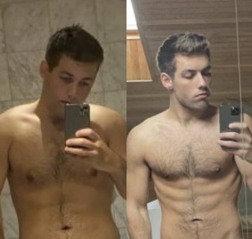 Aksel before and after