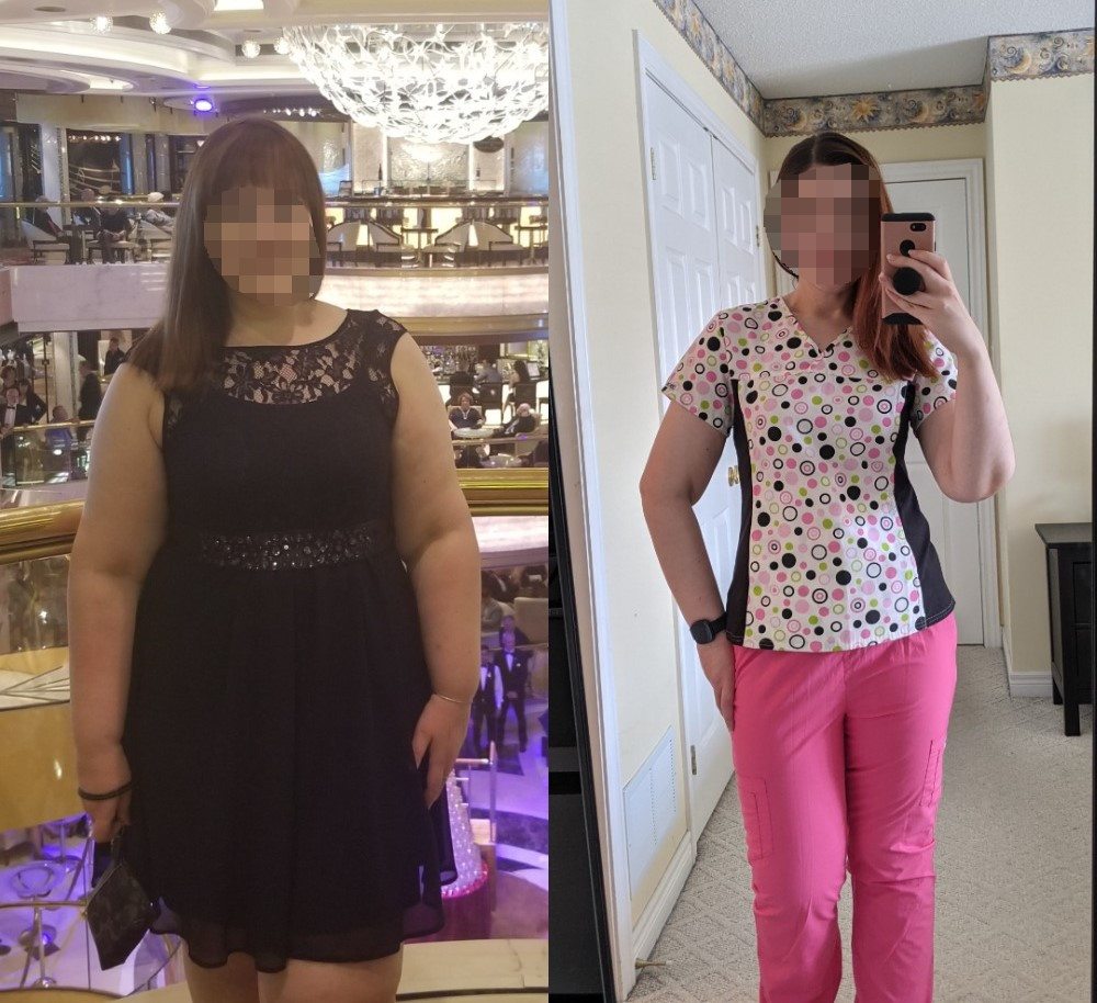 Sarah before and after